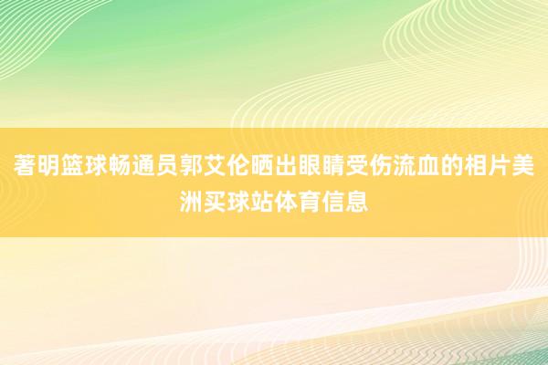 著明篮球畅通员郭艾伦晒出眼睛受伤流血的相片美洲买球站体育信息